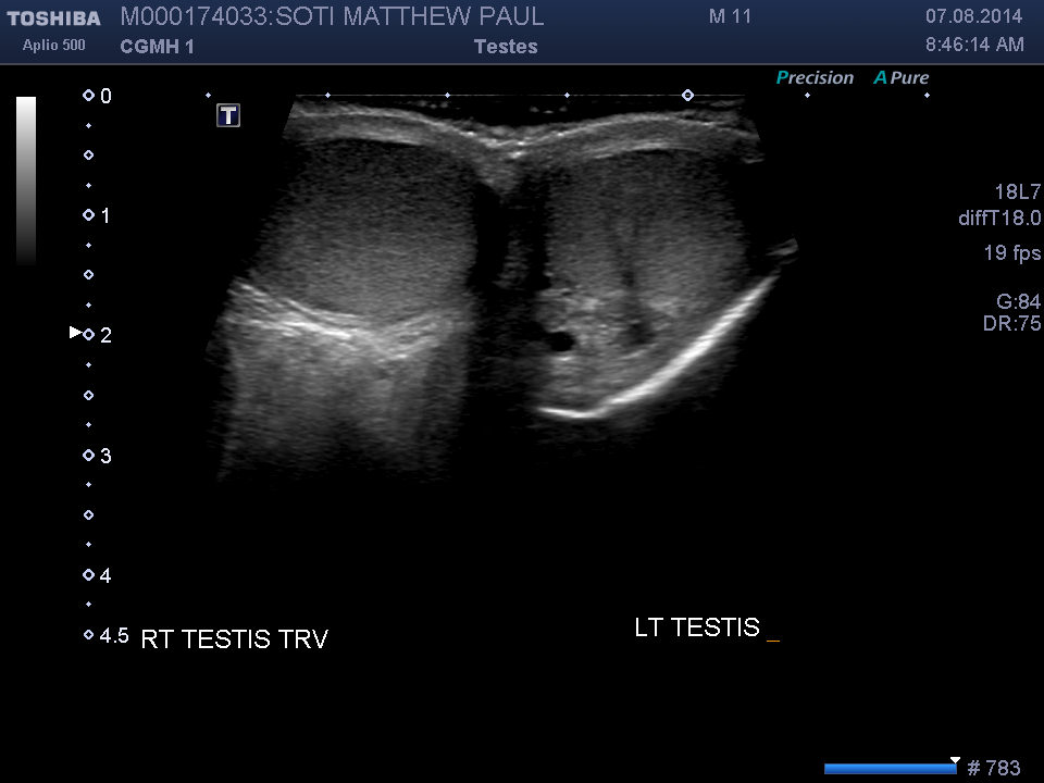 2014-08-07/Ultrasound - Bladder/0002-.png