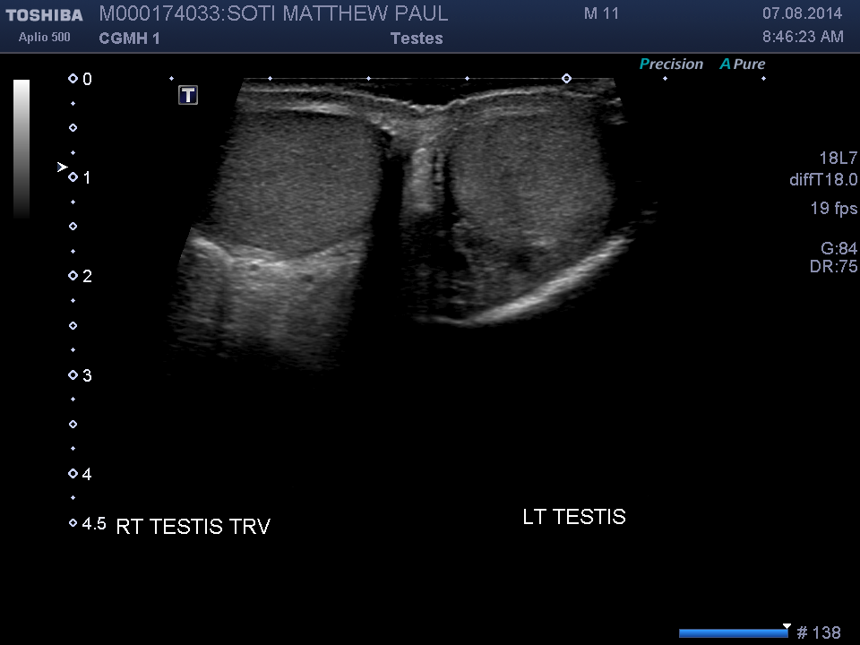 2014-08-07/Ultrasound - Bladder/0003-.png