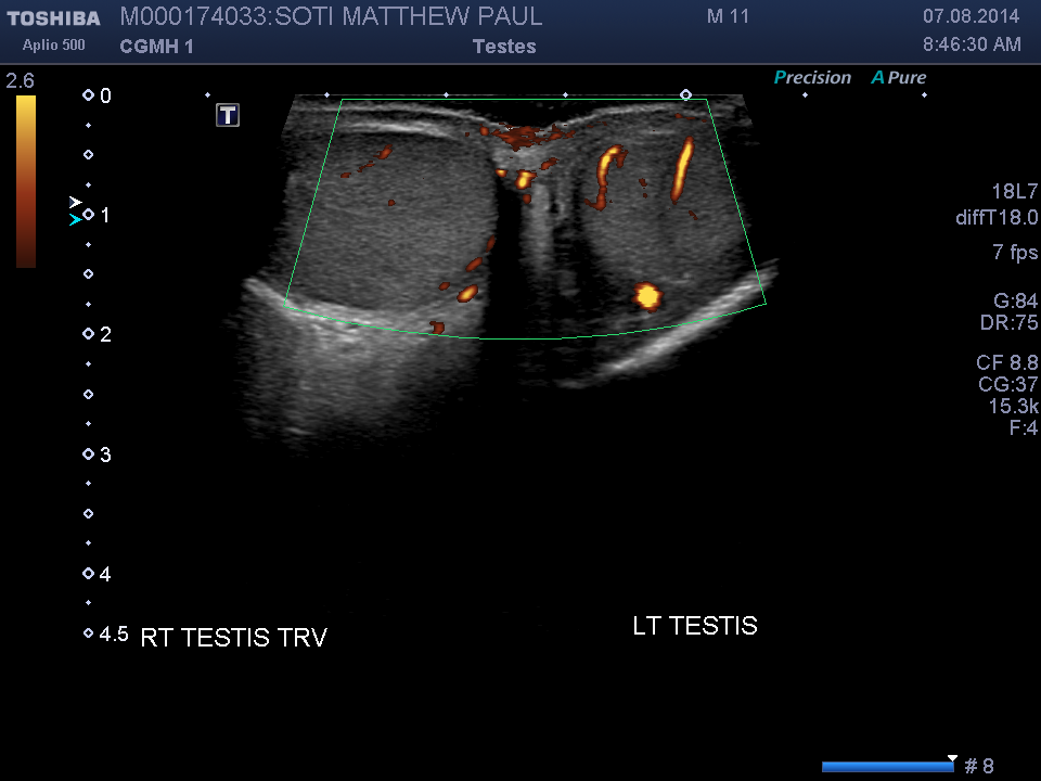 2014-08-07/Ultrasound - Bladder/0004-.png