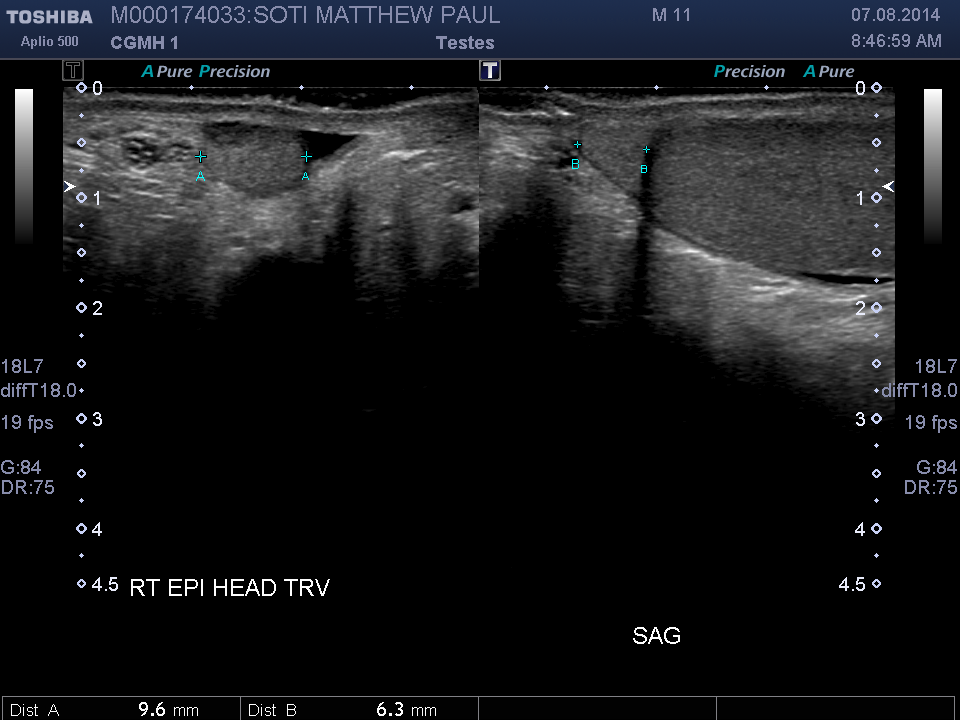 2014-08-07/Ultrasound - Bladder/0005-.png