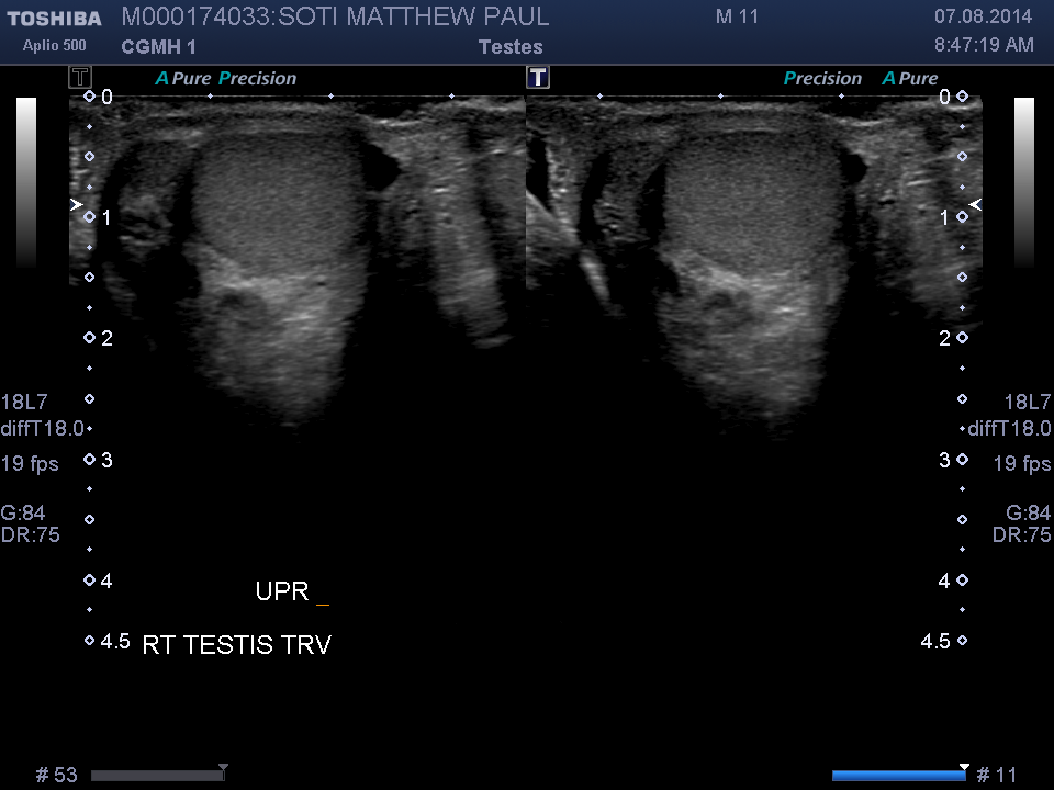 2014-08-07/Ultrasound - Bladder/0006-.png