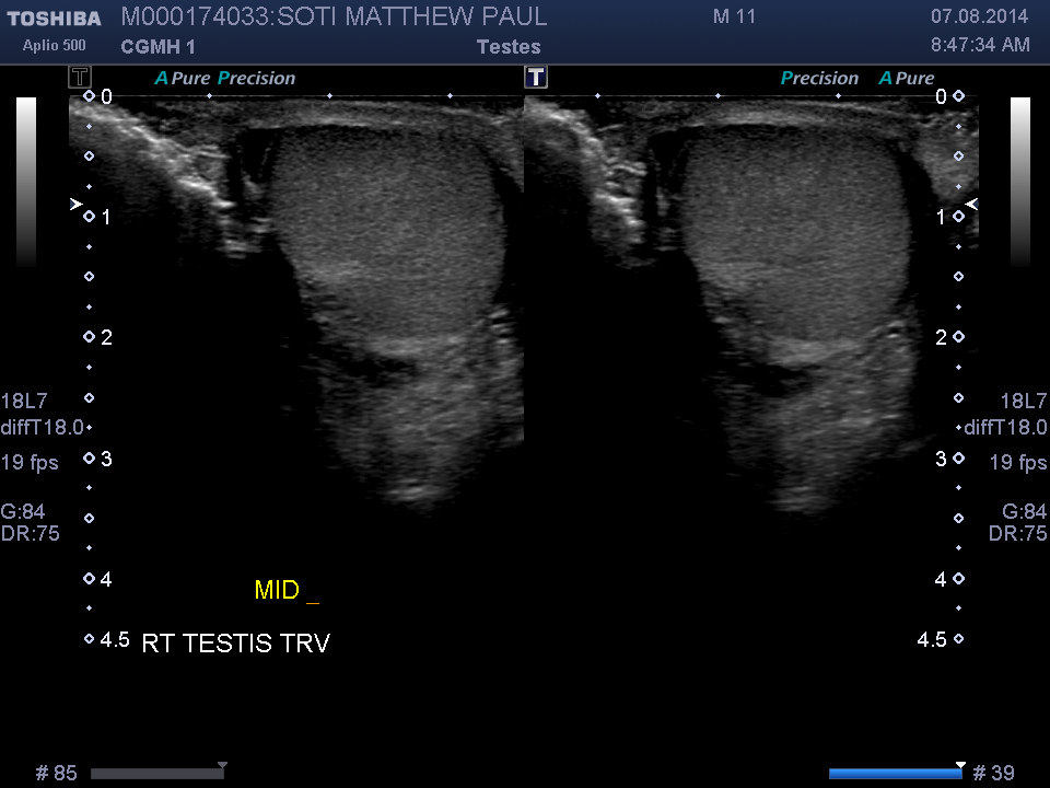 2014-08-07/Ultrasound - Bladder/0007-.png
