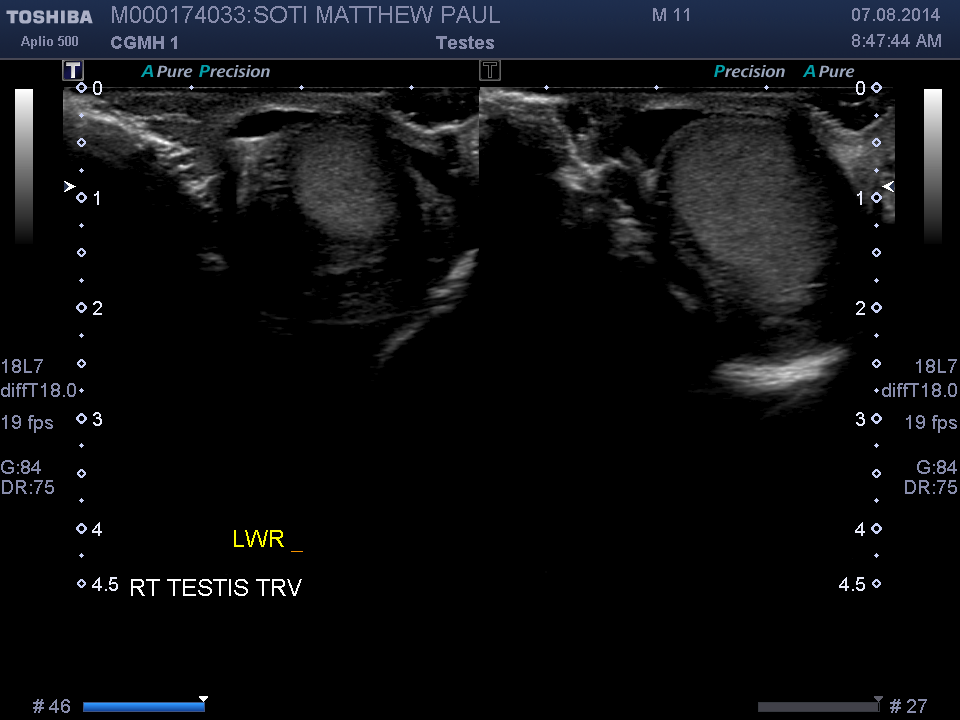 2014-08-07/Ultrasound - Bladder/0008-.png