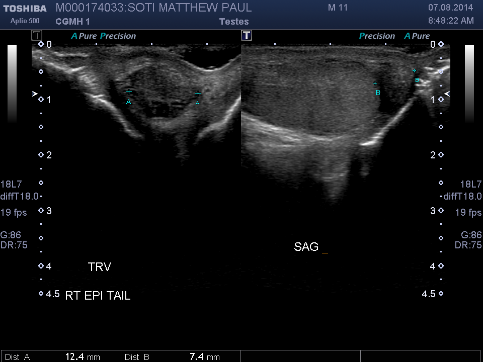 2014-08-07/Ultrasound - Bladder/0009-.png