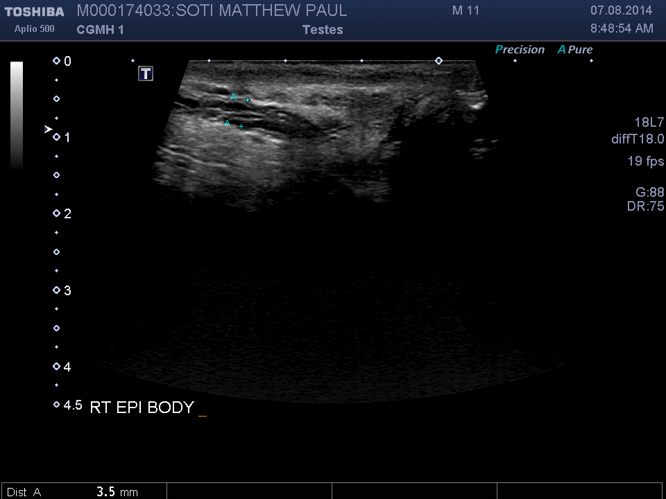 2014-08-07/Ultrasound - Bladder/0010-.png