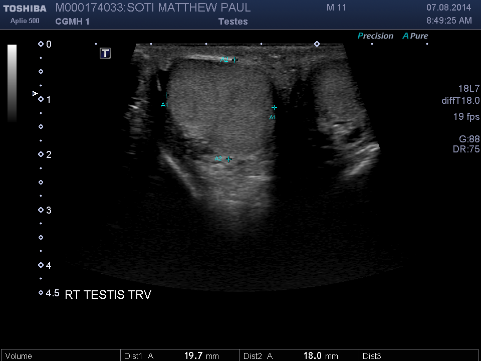 2014-08-07/Ultrasound - Bladder/0011-.png