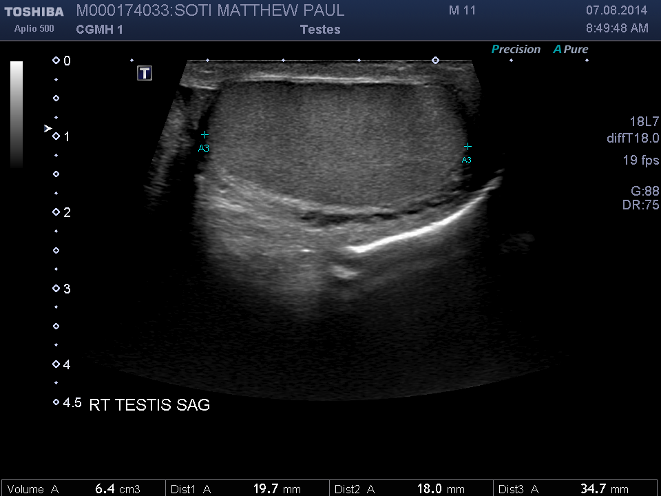 2014-08-07/Ultrasound - Bladder/0012-.png