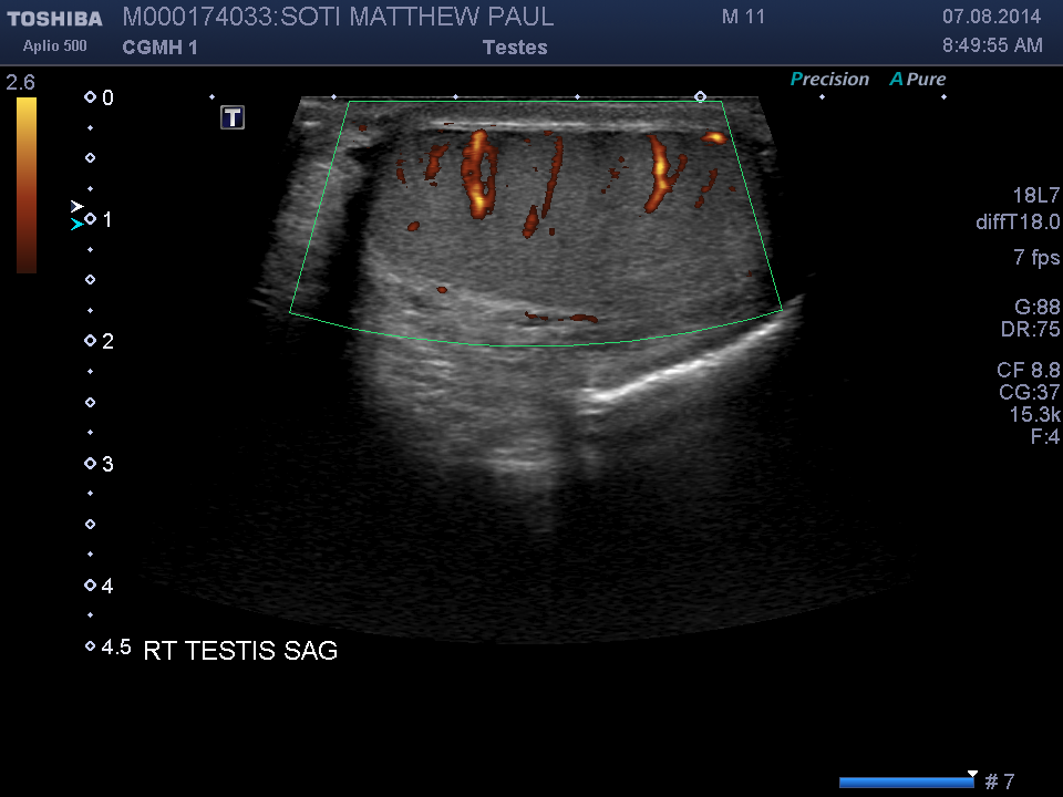 2014-08-07/Ultrasound - Bladder/0013-.png