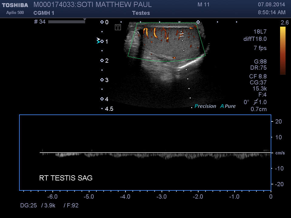 2014-08-07/Ultrasound - Bladder/0014-.png