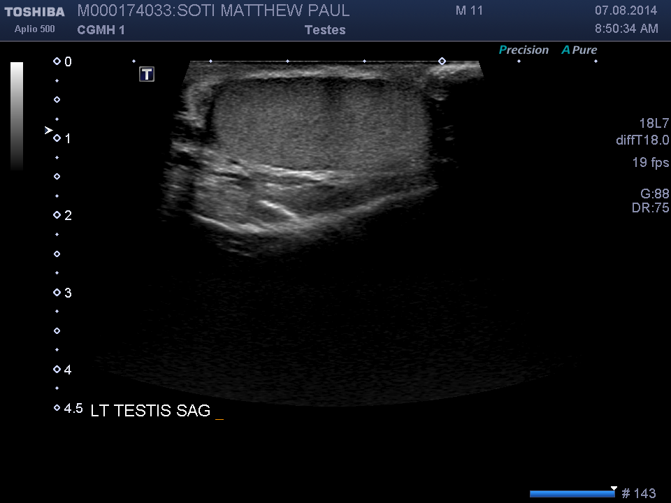 2014-08-07/Ultrasound - Bladder/0015-.png