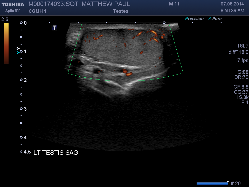 2014-08-07/Ultrasound - Bladder/0016-.png