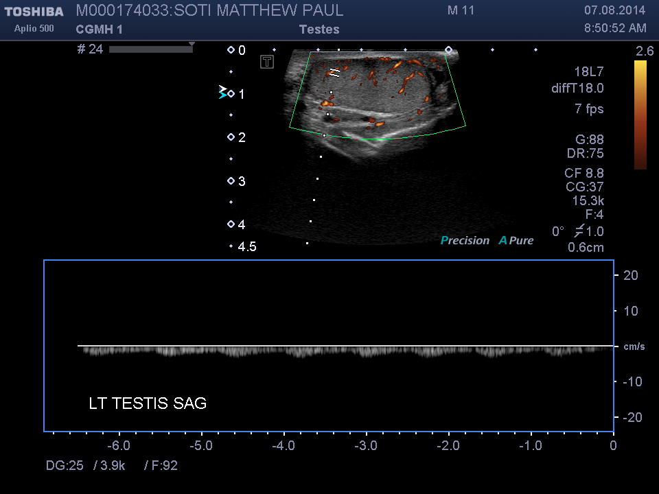 2014-08-07/Ultrasound - Bladder/0017-.png