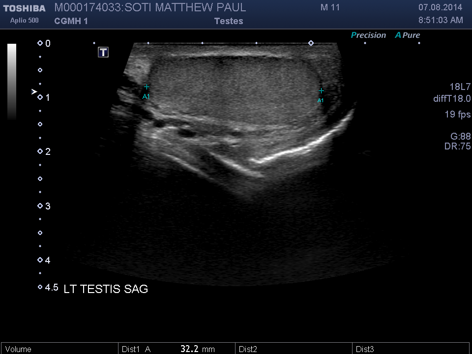 2014-08-07/Ultrasound - Bladder/0018-.png