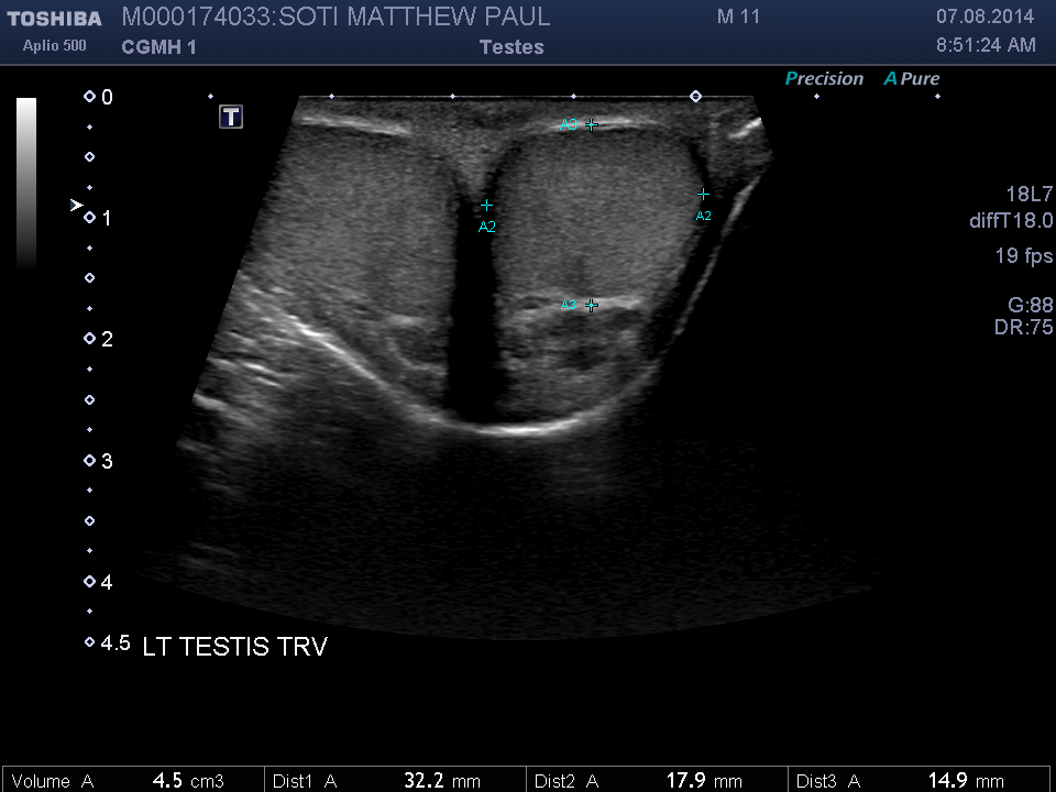 2014-08-07/Ultrasound - Bladder/0019-.png