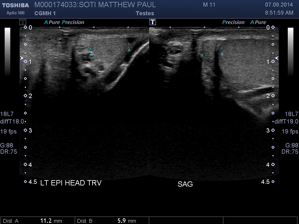 2014-08-07/Ultrasound - Bladder/0020-.png