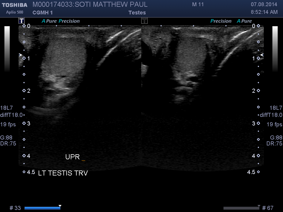 2014-08-07/Ultrasound - Bladder/0021-.png