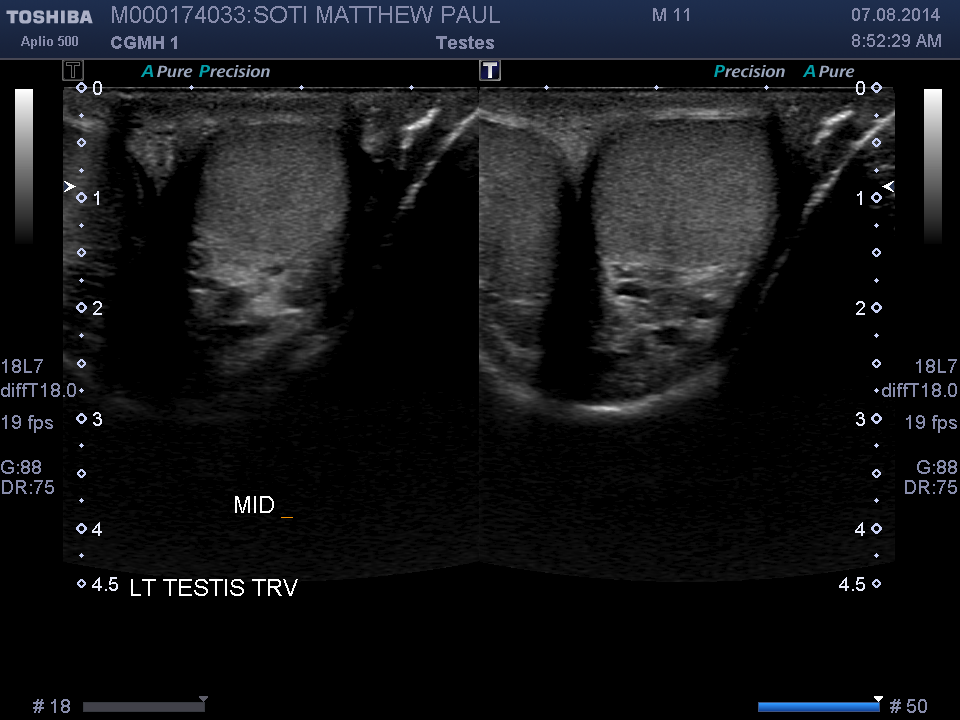 2014-08-07/Ultrasound - Bladder/0022-.png