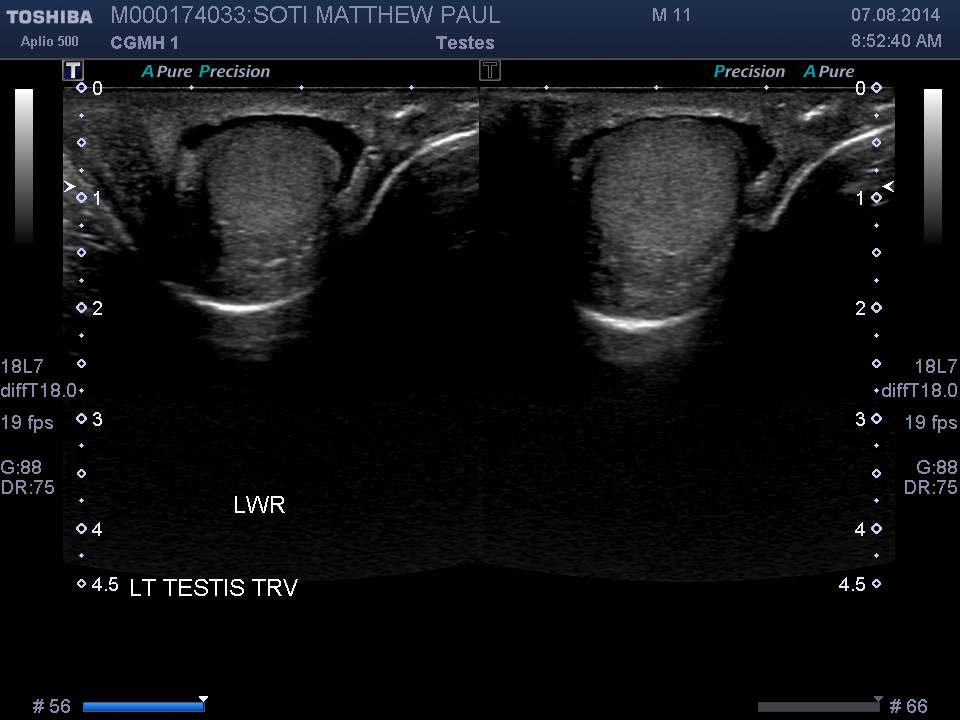 2014-08-07/Ultrasound - Bladder/0023-.png