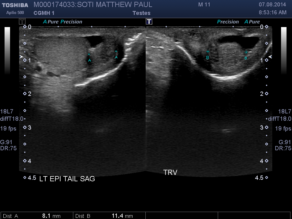 2014-08-07/Ultrasound - Bladder/0024-.png
