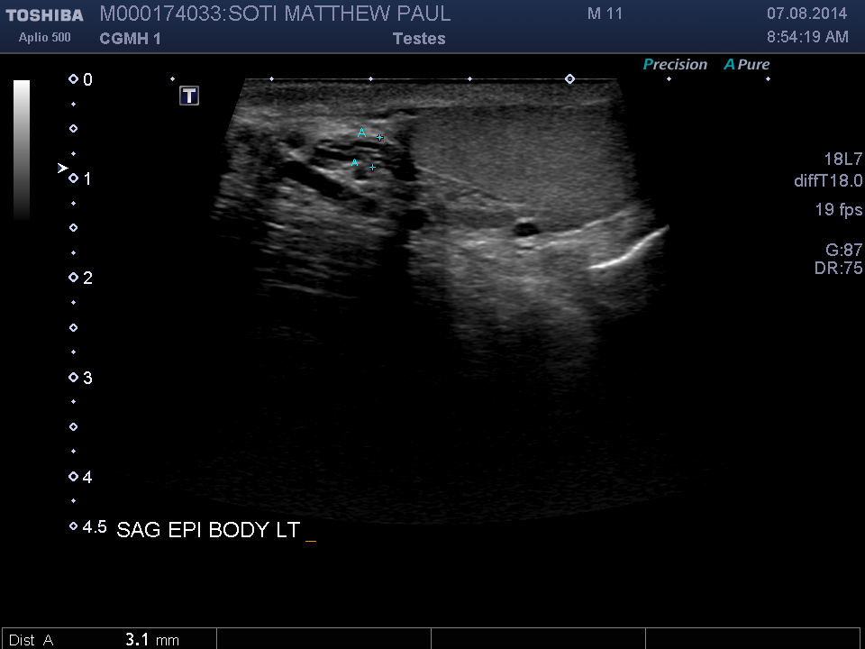 2014-08-07/Ultrasound - Bladder/0025-.png