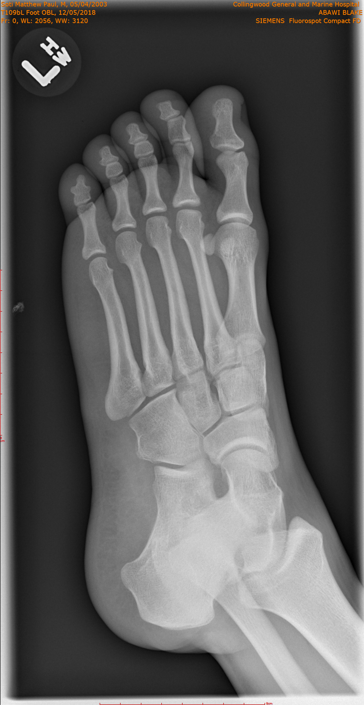 2018-12-05/T109bL Foot OBL/0001-.png