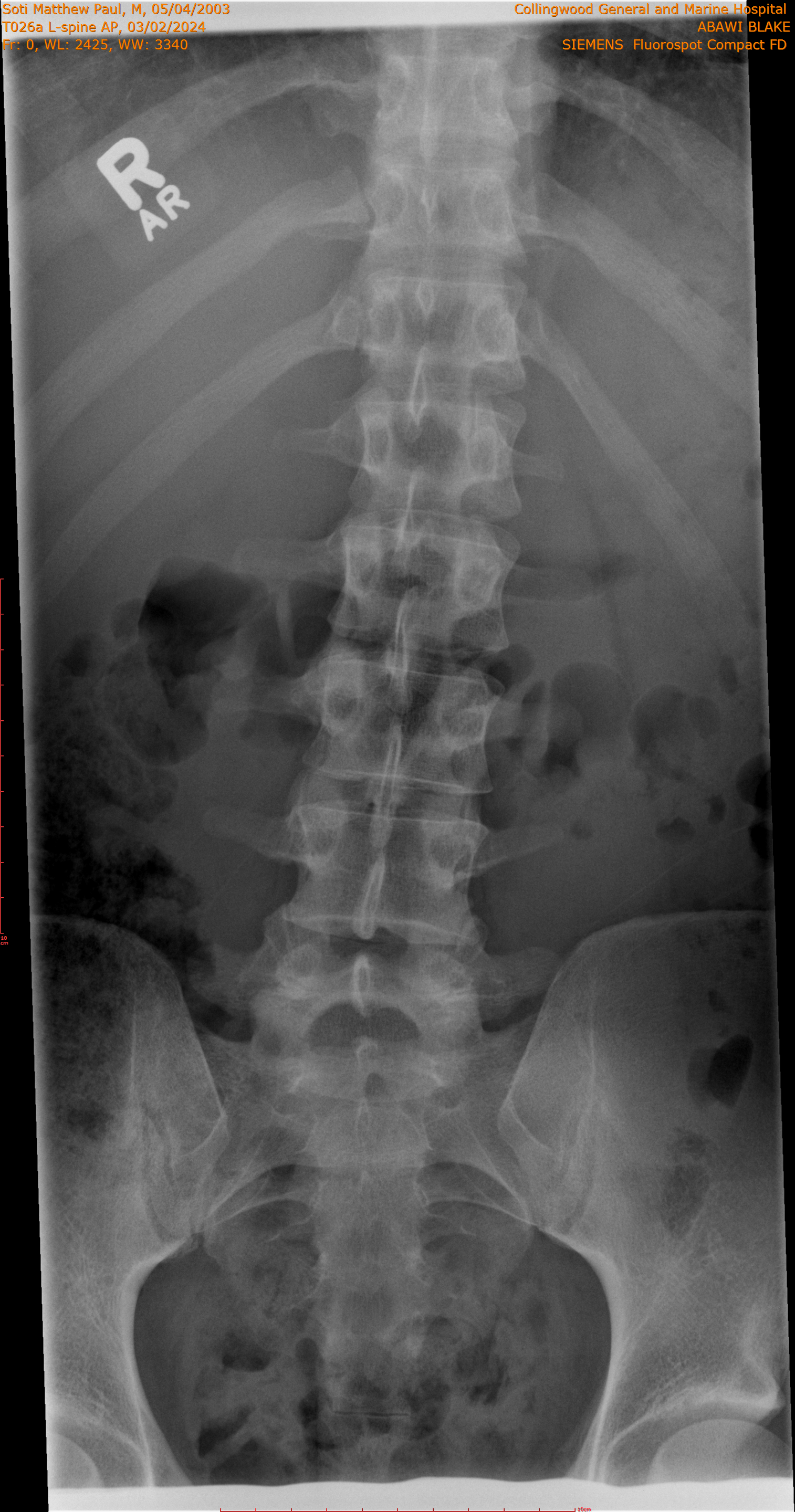 2024-03-02/T026a L-spine AP/0001-.png