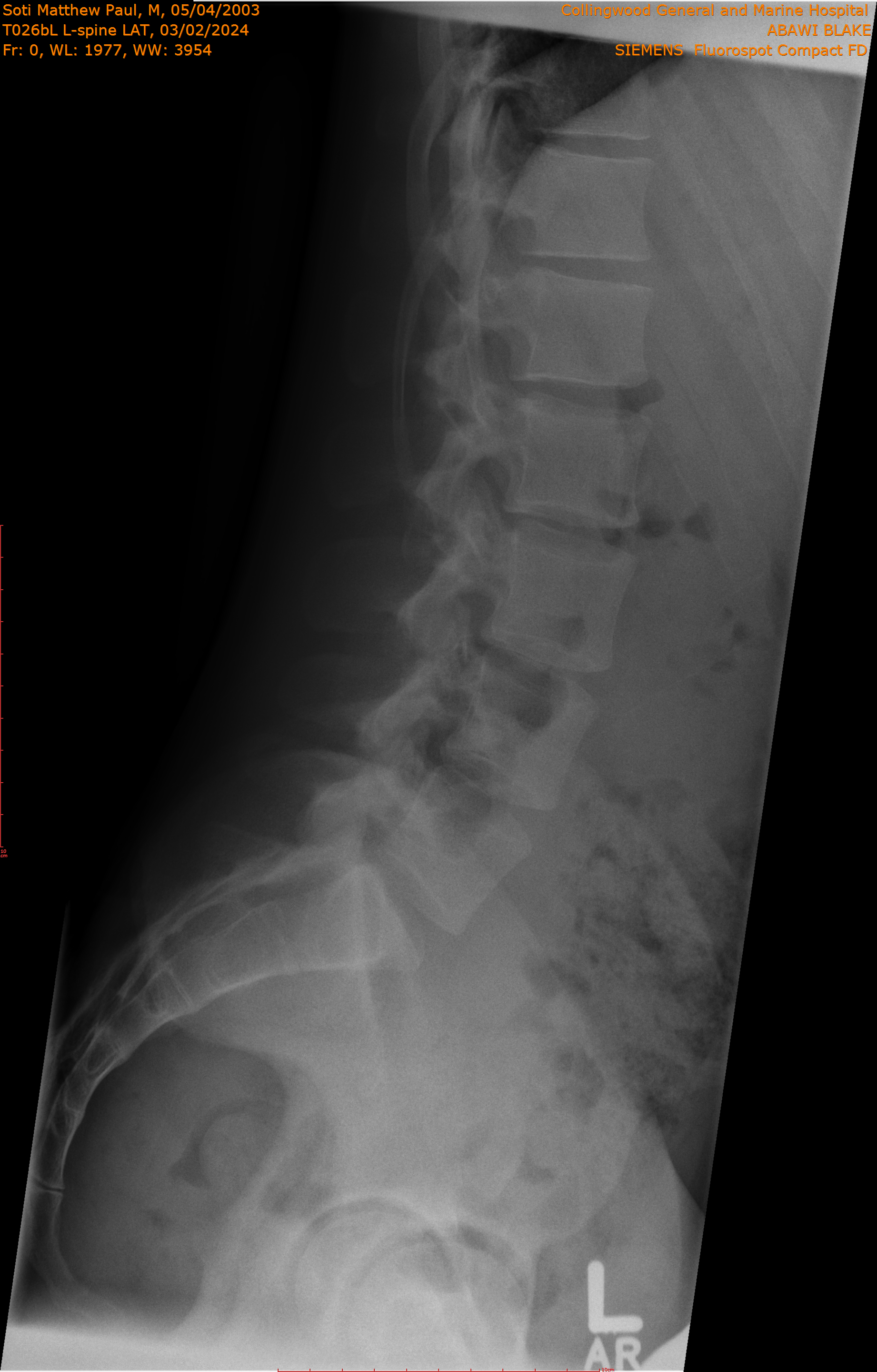 2024-03-02/T026bl L-spine LAT/0001-.png