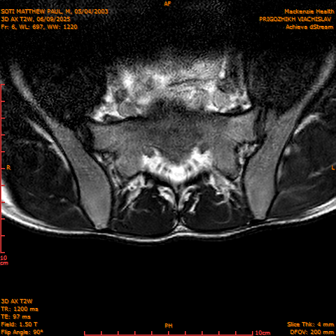 2025-06-09/3D AX T2W/0007-.png