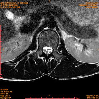 2025-06-09/AX T2 TSP/0001-IM187.png