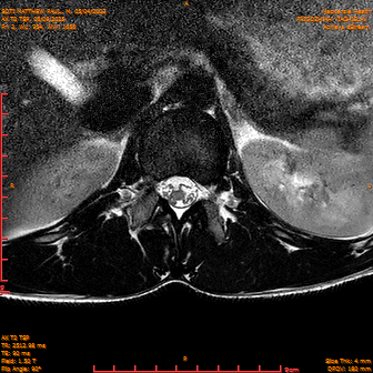 2025-06-09/AX T2 TSP/0003-IM189.png