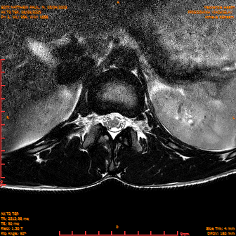 2025-06-09/AX T2 TSP/0004-IM190.png
