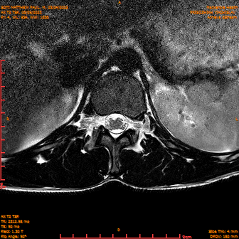 2025-06-09/AX T2 TSP/0005-IM191.png