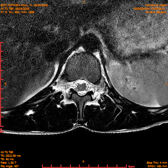 2025-06-09/AX T2 TSP/0006-IM192.png