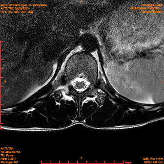 2025-06-09/AX T2 TSP/0007-IM193.png