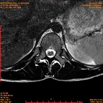 2025-06-09/AX T2 TSP/0008-IM194.png