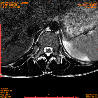 2025-06-09/AX T2 TSP/0009-IM195.png