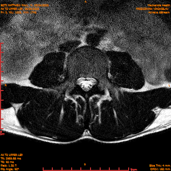 2025-06-09/AX T2 UPPER LSP/0003-IM164.png