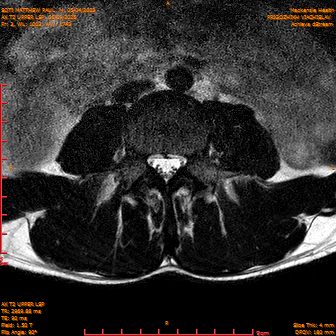 2025-06-09/AX T2 UPPER LSP/0004-IM165.png