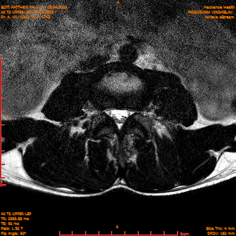2025-06-09/AX T2 UPPER LSP/0005-IM166.png