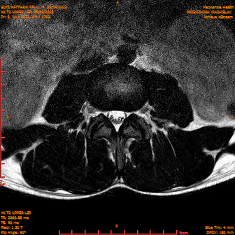 2025-06-09/AX T2 UPPER LSP/0006-IM167.png