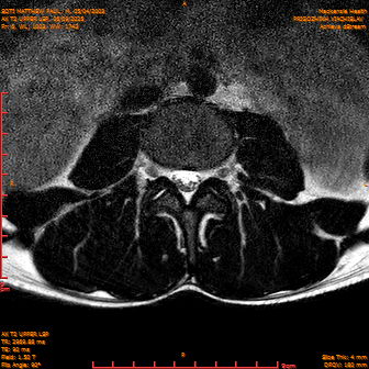 2025-06-09/AX T2 UPPER LSP/0007-IM168.png