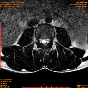 2025-06-09/AX T2 UPPER LSP/0009-IM170.png