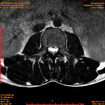 2025-06-09/AX T2 UPPER LSP/0011-IM172.png
