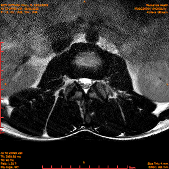 2025-06-09/AX T2 UPPER LSP/0013-IM174.png