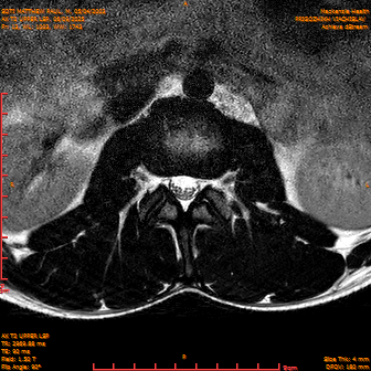 2025-06-09/AX T2 UPPER LSP/0014-IM175.png