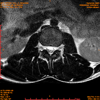 2025-06-09/AX T2 UPPER LSP/0015-IM176.png