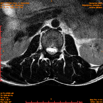 2025-06-09/AX T2 UPPER LSP/0017-IM178.png