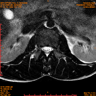 2025-06-09/AX T2 UPPER LSP/0020-IM181.png