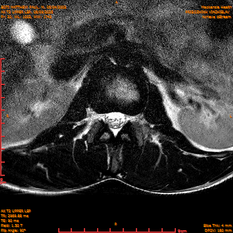 2025-06-09/AX T2 UPPER LSP/0021-IM182.png