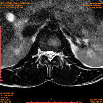 2025-06-09/AX T2 UPPER LSP/0022-IM183.png
